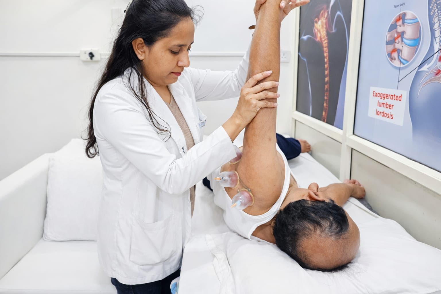 Cupping Therapy for Shoulder Muscle Stiffness